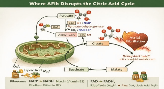 Atrial Fibrillation